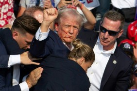 What Happened Between Donald Trump & FBI Director? Bullet Injury Explained