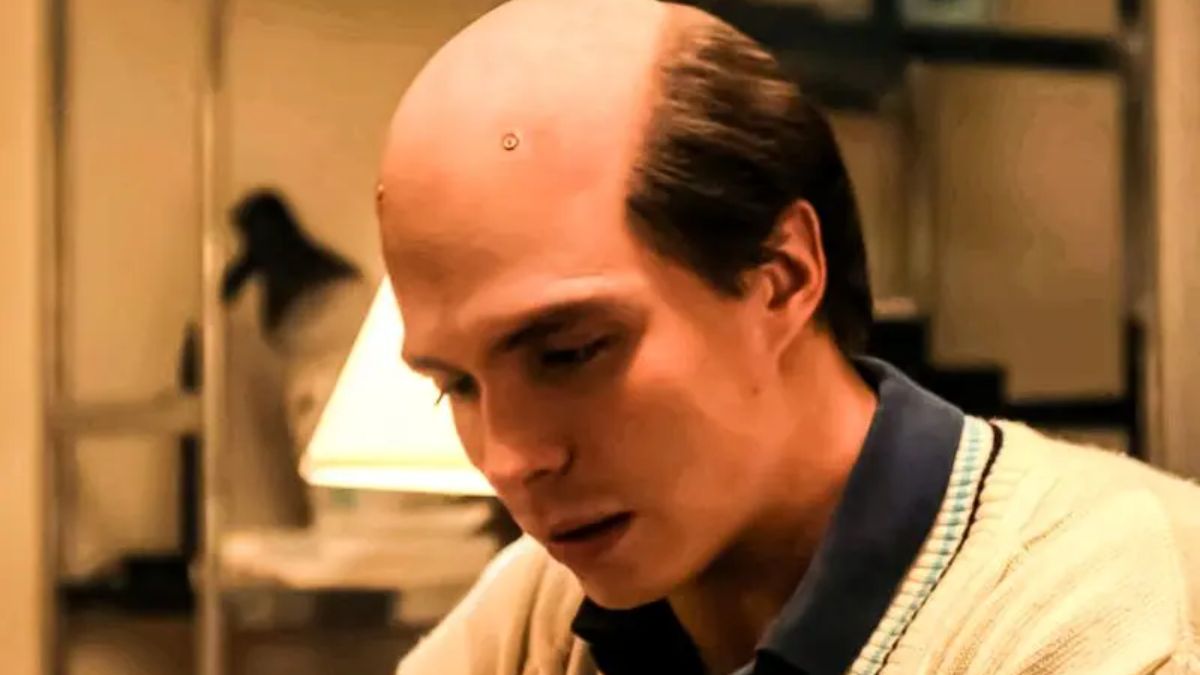 Monsters Netflix Why Did Lyle Menendez Have Screws on His Head?