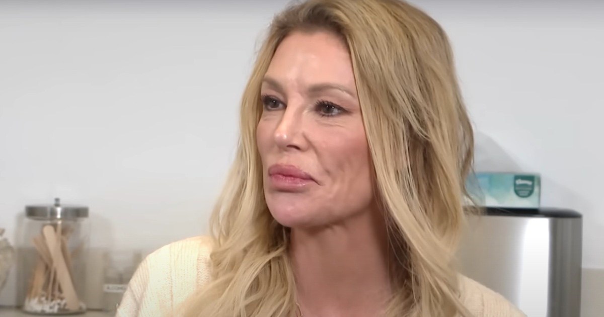 Brandi Glanville Share Details of Face ‘Parasite’