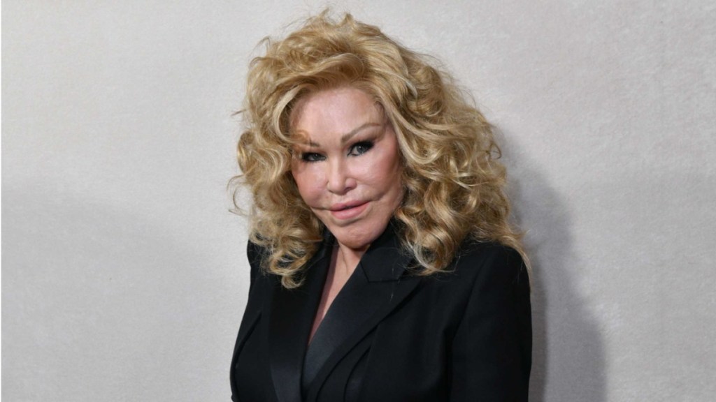 What Happened to Jocelyn Wildenstein? 'Catwoman' Socialite Passes Away