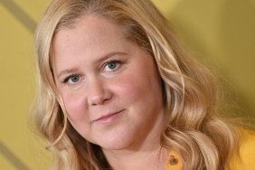 What Is Moon Face Amy Schumer Cushing Syndrome Disease Causes