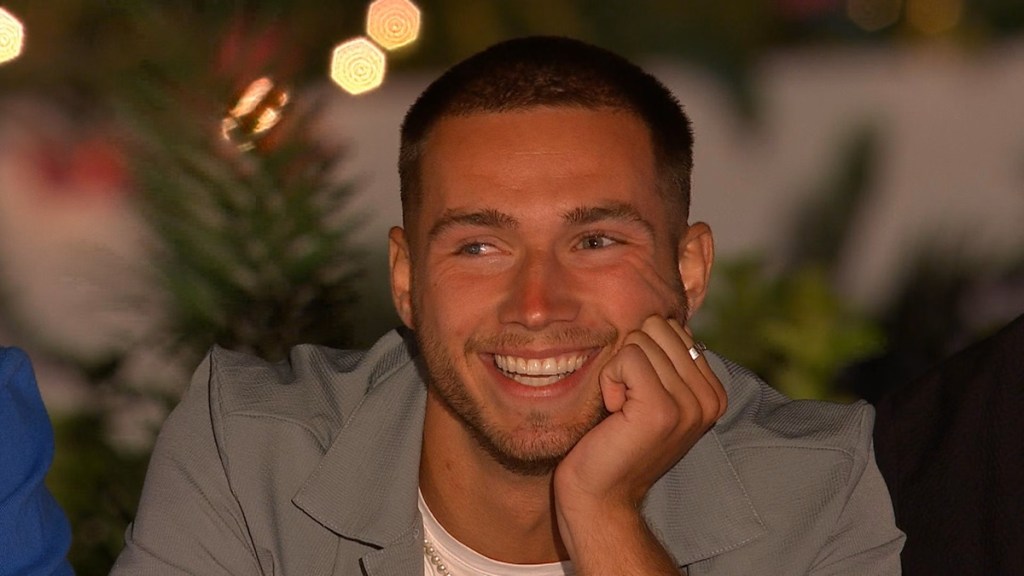 What Happened to Ron Hall's Eye Before Love Island: All Stars?