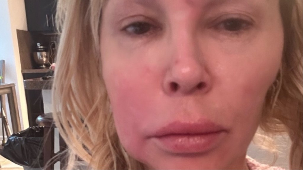 brandi glanville face teeth